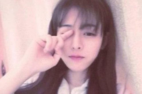 睡眠性休克怎么治疗