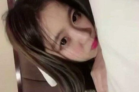 焦虑症抑郁共病如何治疗